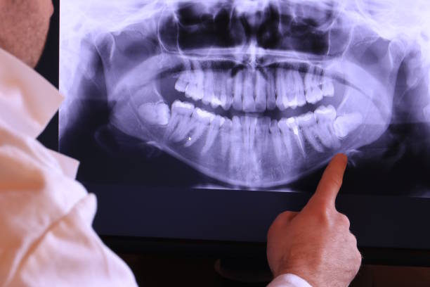 Best Walk-In Emergency Dentist in Dillsboro, IN